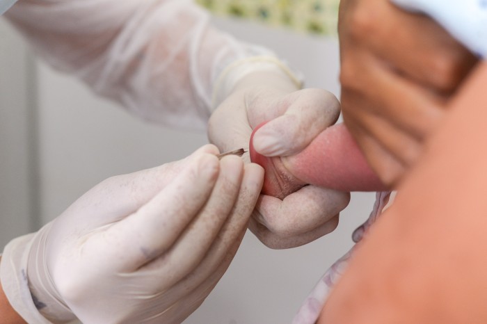 Unidades de saúde realizam teste do pezinho gratuitamente na Capital