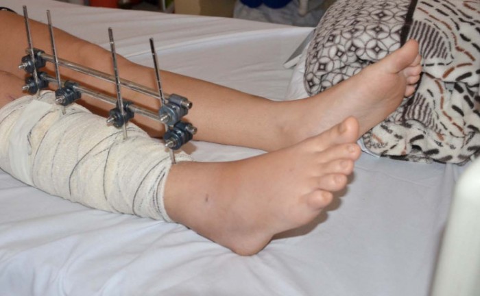 Saúde chama a atenção dos motoristas para os cuidados nas estradas 