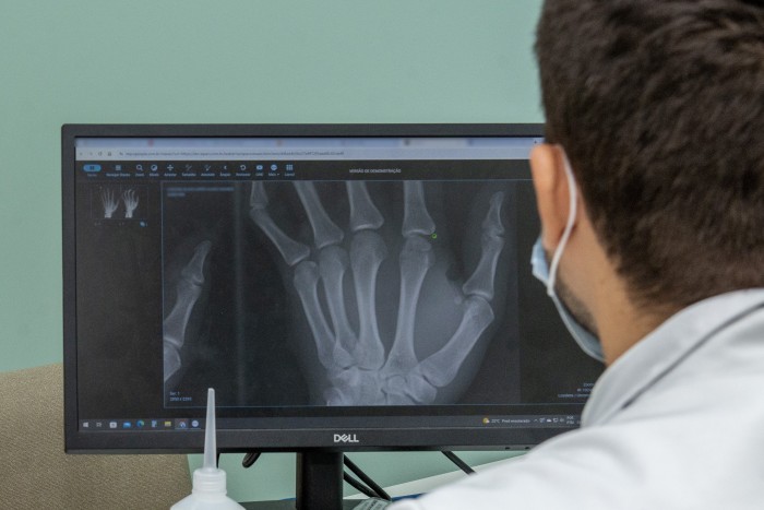 Mais de 300 pessoas passaram pela ortopedia desde implantação do serviço